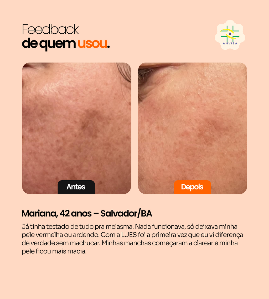 Kit Clareador de Melasma + Colágeno