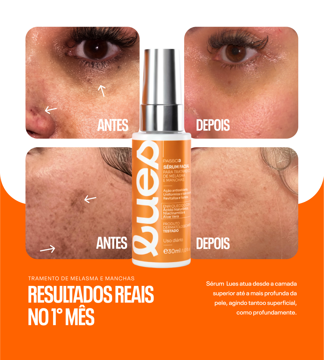 Sérum Facial NanoVoid™ Anti-Manchas