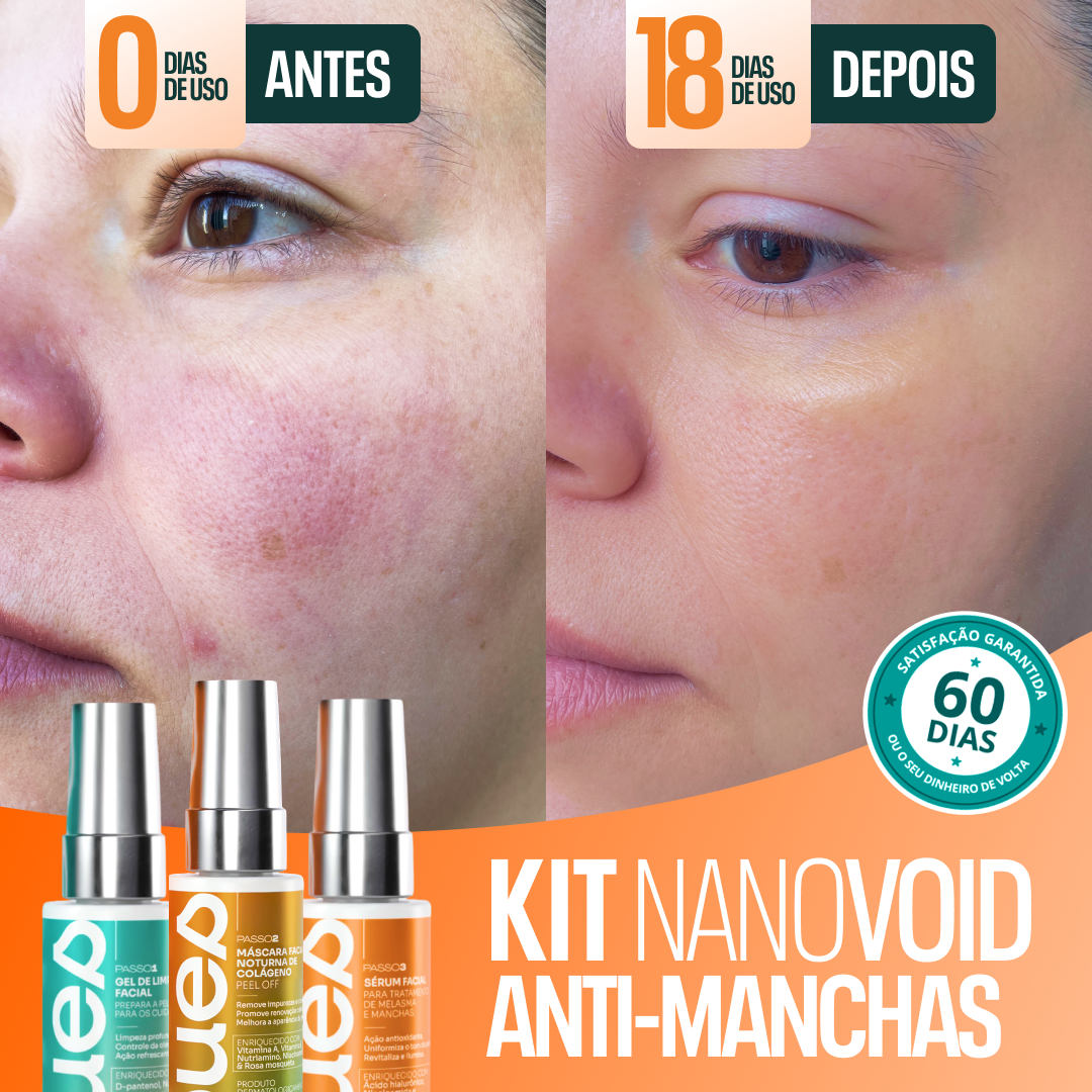 Kit Clareador NanoVoid